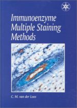 immunoenzyme multiple staining methods