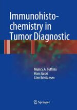 immunohistochemistry