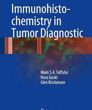 immunohistochemistry