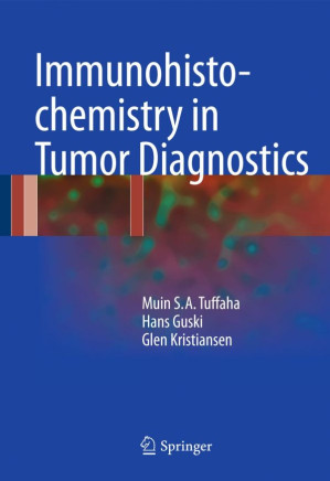 immunohistochemistry in tumor diagnostics