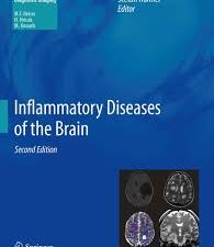 inflammatory diseases of the brain (medical radiology / diagnostic imaging) – 2013