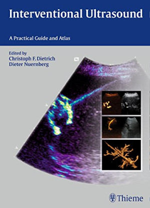 interventional ultrasound: a practical guide and atlas (2014 release)