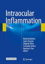 intraocular inflammation