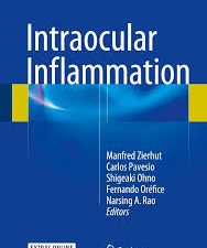 intraocular inflammation