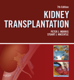 kidney transplantation – principles and practice: expert consult – online and print (morris,kidney transplantation) 7th edition