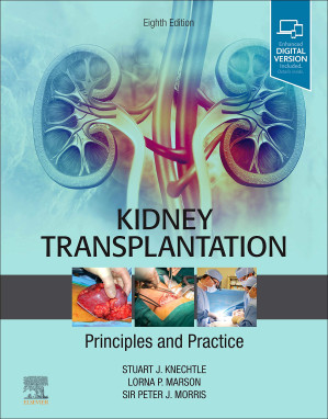 kidney transplantation – principles and practice: expert consult – online and print 8th edition