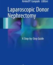 laparoscopic donor nephrectomy: a step by step guide
