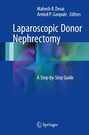 laparoscopic donor nephrectomy: a step by step guide