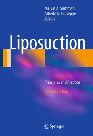 liposuction: principles and practice, 2nd edition