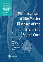 mr imaging in white matter diseases of the brain and spinal cord (medical radiology / diagnostic imaging)