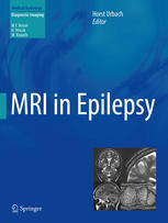 mri in epilepsy (medical radiology / diagnostic imaging) – 2013 edition