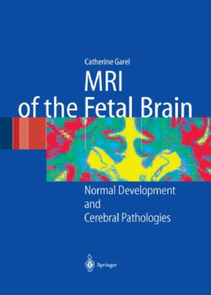 mri of the fetal brain: normal development and cerebral pathologies