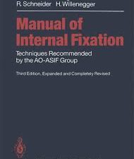 manual of internal fixation: techniques recommended by the ao asif group