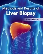 methods and results of liver biopsy