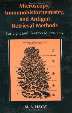 microscopy, immunohistochemistry, and antigen retrieval methods: for light and electron microscopy