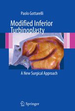 modified inferior turbinoplasty: a new surgical approach