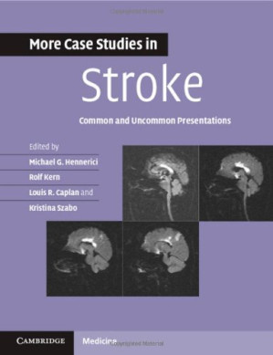 more case studies in stroke: common and uncommon presentations