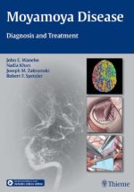 moyamoya disease: diagnosis and treatment 1st edition