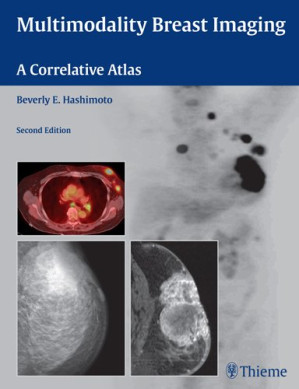 multimodality breast imaging: a correlative atlas – 2nd edition