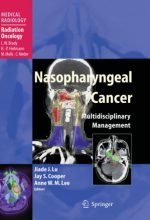 nasopharyngeal cancer