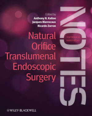 natural orifice translumenal endoscopic surgery: textbook and video atlas