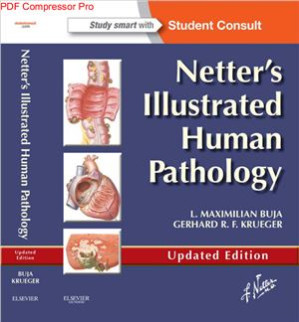 netter’s illustrated human pathology updated edition