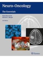 neuro oncology