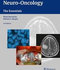 neuro oncology