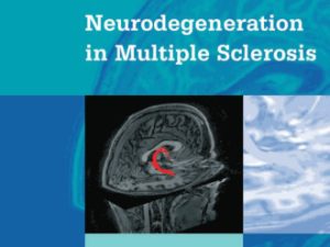 neurodegeneration in multiple sclerosis