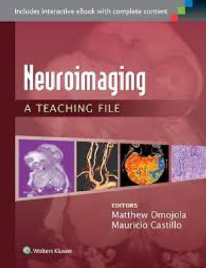 neuroimaging: a teaching file (lww teaching file series) – 2014 release