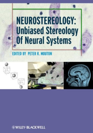 neurostereology: unbiased stereology of neural systems