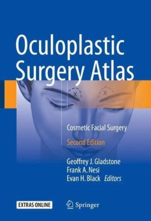 oculoplastic surgery atlas: cosmetic facial surgery, second edition