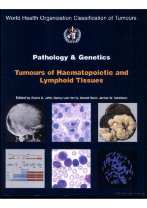pathology and genetics: tumours of haematopoietic and lymphoid tissues