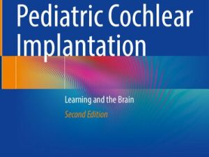 pediatric cochlear implantation: learning and the brain