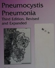 pneumocystis pneumonia, third edition (lung biology in health and disease)