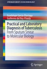 practical and laboratory diagnosis of tuberculosis: from sputum smear to molecular biology