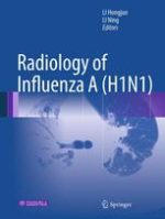 radiology of influenza a (h1n1)