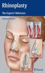 rhinoplasty: the experts’ reference (march 2015 release)