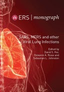 sars, mers and other viral lung infections
