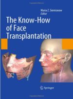 the know how of face transplantation