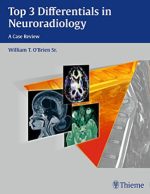 top 3 differentials in neuroradiology (april 2015 release)