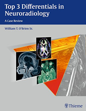 top 3 differentials in neuroradiology (april 2015 release)