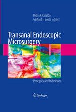 transanal endoscopic microsurgery: principles and techniques