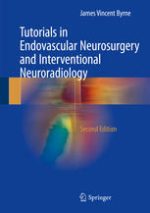 tutorials in endovascular neurosurgery and interventional neuroradiology, second edition