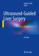 ultrasound guided liver surgery: an atlas (2014)