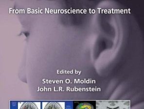 understanding autism: from basic neuroscience to treatment