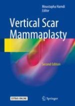 vertical scar mammaplasty, second edition