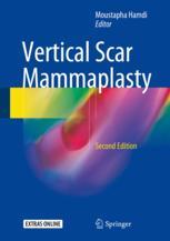 vertical scar mammaplasty, second edition