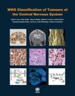 who classification of tumours of the central nervous system (iarc who classification of tumours)