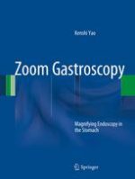 zoom gastroscopy: magnifying endoscopy in the stomach (2014)